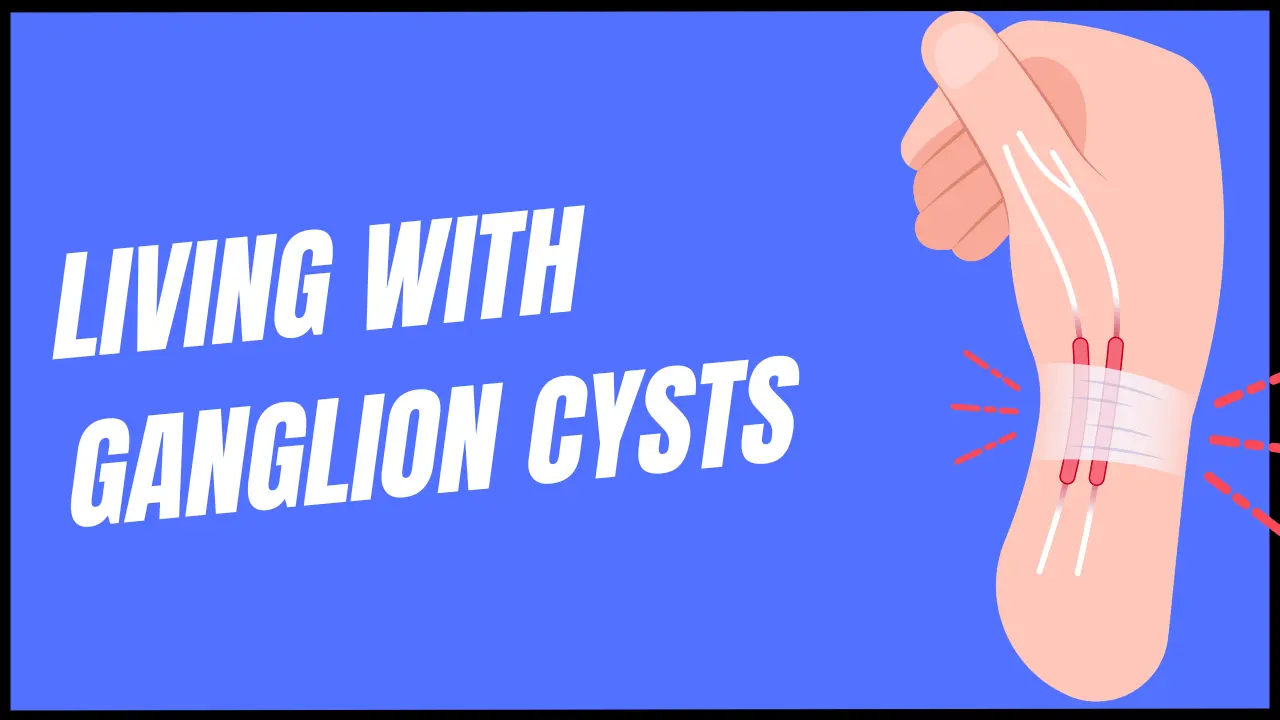 Ganglion cyst vitamin deficiency